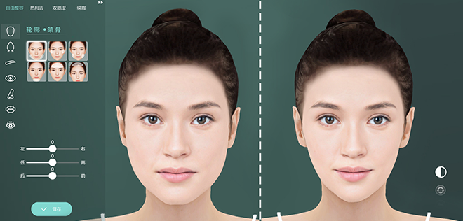 什么是數(shù)字3D整形？